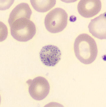 Peripheral blood-smear image for morphology question 5